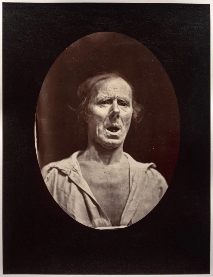 Figure 54: Abaissement volontaire de la mâchoire inférieure: mouvement inexpressif